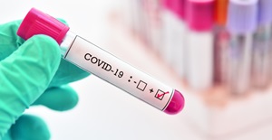Test tube with Covid 19 sample