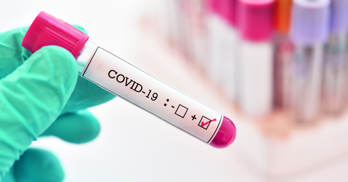 Test tube with Covid 19 sample