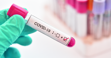 Test tube with Covid 19 sample