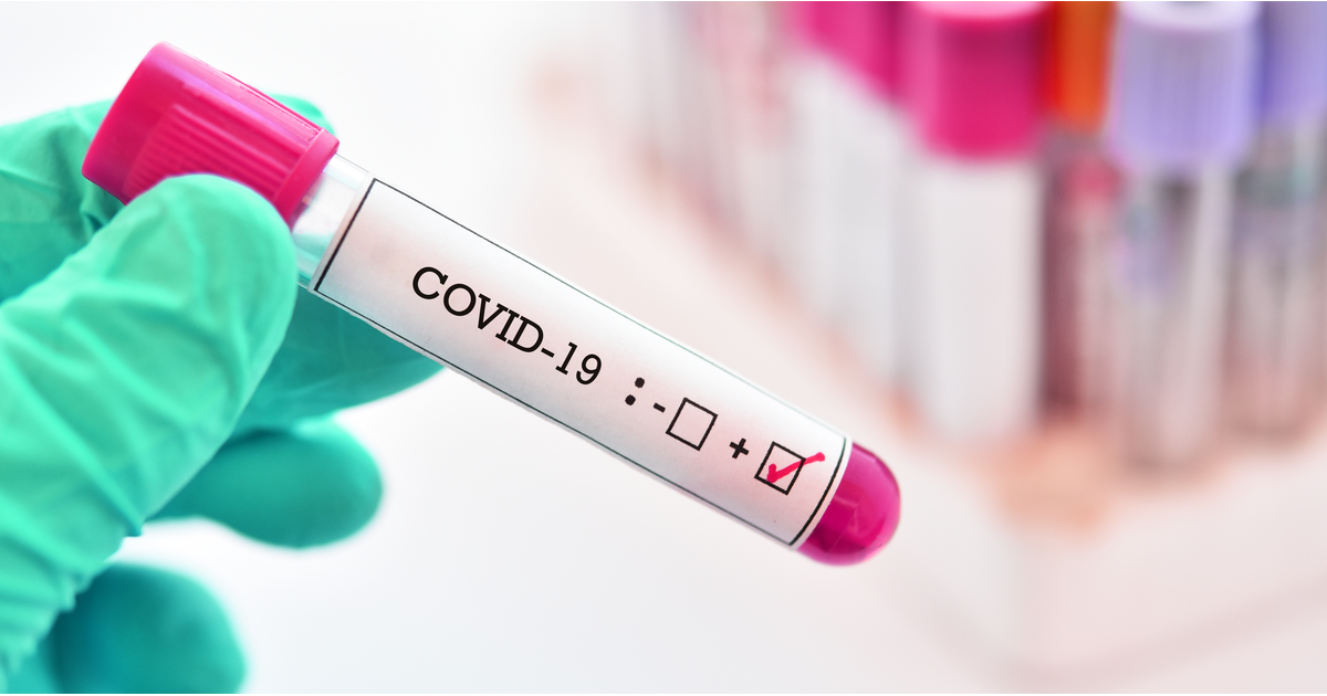 Test tube with Covid 19 sample